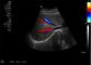 Cyfrowy skaner ultradźwiękowy Przenośny skaner ultrasonograficzny 4D Sonda serca Opcjonalnie