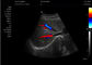 Medyczna maszyna ultradźwiękowa Przenośny ultrasonograf 4d Sprzęt ultradźwiękowy
