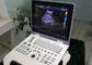 4d Ultrasound Machine Przenośny skaner ultradźwiękowy o pojemności 120G 4800 klatek Cine Loop