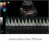 Kolorowy system ultrasonograficzny Doppler Przenośny ultrasonograf z 12,1-calowym monitorem LED i 2 portami sondy
