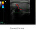 Przenośny ultrasonograf Przenośny ultrasonograf z opcjonalnym 3D i wagą 5,5 kg