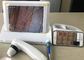 Ręczny cyfrowy dermatoskop wideo z 8-calowym ekranem 1,4,9 Wyświetlanie zdjęć