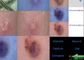 Wideo Dermatoskop z detektorem skóry i skóry głowy z raportem Analysisi o zawartości pigmentów olejowych elastycznych