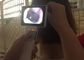 Karta SD Cyfrowa Otoskop Wideo do Kontroli Body ludzkiej z 3,5-calowym monitorem LCD