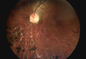 3,5-calowy sprzęt okulistyczny do diagnostyki jaskry i cukrzycy