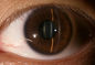 3,5-calowy sprzęt okulistyczny do diagnostyki jaskry i cukrzycy