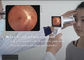 Diagnostyka oka Cyfrowy aparat fotograficzny dna oka do chorób dna oka