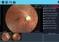 3,5-calowy ekran dotykowy Medyczny cyfrowy system okulistyczny Dostępna jest cyfrowa kamera dna oka