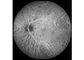 Retina Angiograph Digital 160 ° Sprzęt okulistyczny
