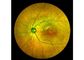 Retina Angiograph Digital 160 ° Sprzęt okulistyczny