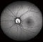Cyfrowa kamera dna oka Confocal Retina z FOV 15 °, 30 °, 60 ° Rozmiar obrazu 1024 * 1024