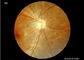 Medyczny sprzęt okulistyczny do przenośnego aparatu dna oka