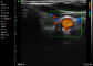 Przenośny skaner ultradźwiękowy Ipad Przenośny kolorowy doppler Naczynia brzucha Pediatria Ginekologia