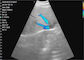 Cyfrowe przenośne ręczne przenośne urządzenie ultrasonograficzne Convex + Linear + Cardiac 3IN1 Bezprzewodowy przetwornik ultradźwiękowy