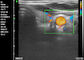 Strona główna USG Doppler Przenośna diagnostyka Ręczna ultrasonografia dopplerowska Położnictwo Ginekologia Pediatria Aplikacja