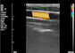 Kolorowa maszyna ultrasonograficzna Domowy skaner ultrasonograficzny Przenośny ultrasonograf do ciąży 8 TGC 3,5 ~ 10 MHz