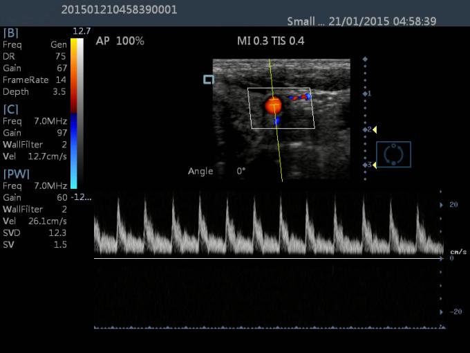 15-calowy dotykowy LCD 2D ultradźwiękowy kolor Dopple Przenośny diagnostyczny ultradźwięk