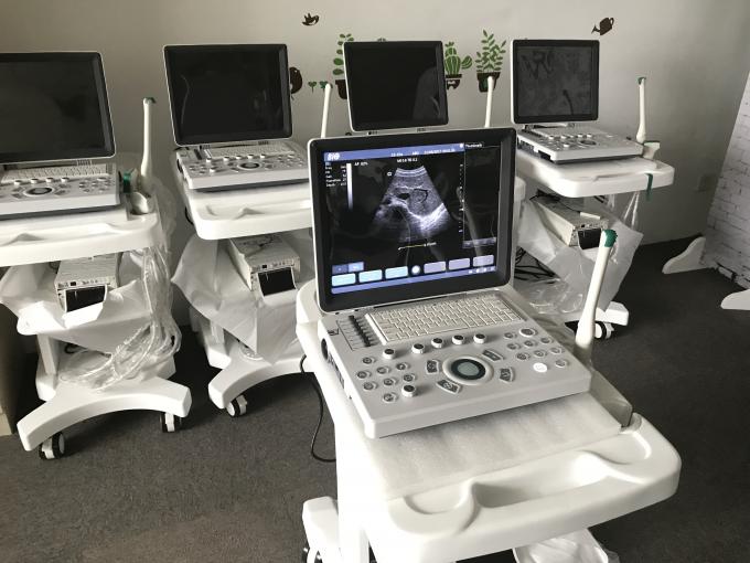 15 calowy pełny cyfrowy przenośny skaner ultradźwiękowy Medyczny sprzęt diagnostyczny