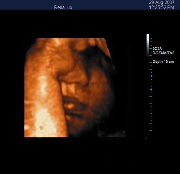 Przenośny ultrasonograf 3D z kolorowym ultrasonografem dopplerowskim z 15-calowym ekranem LED