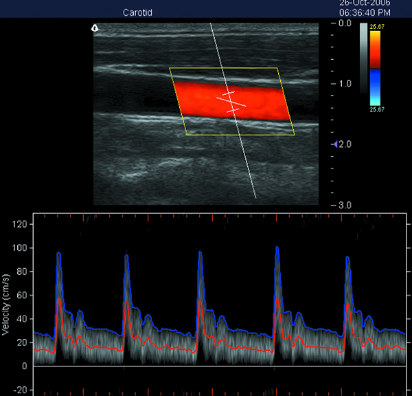 Przenośny ultrasonograf 3D z kolorowym ultrasonografem Doppler z 15-calowym ekranem LED