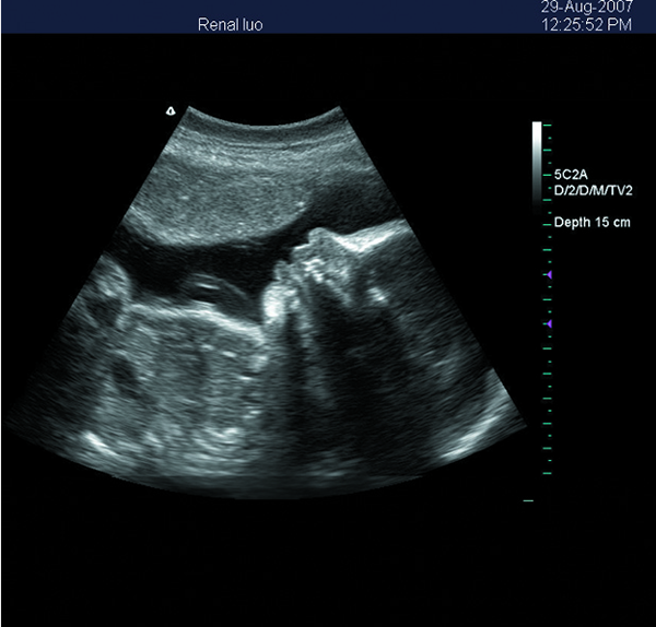 Przenośny ultrasonograf 3D z kolorowym ultrasonografem dopplerowskim z 15-calowym ekranem LED