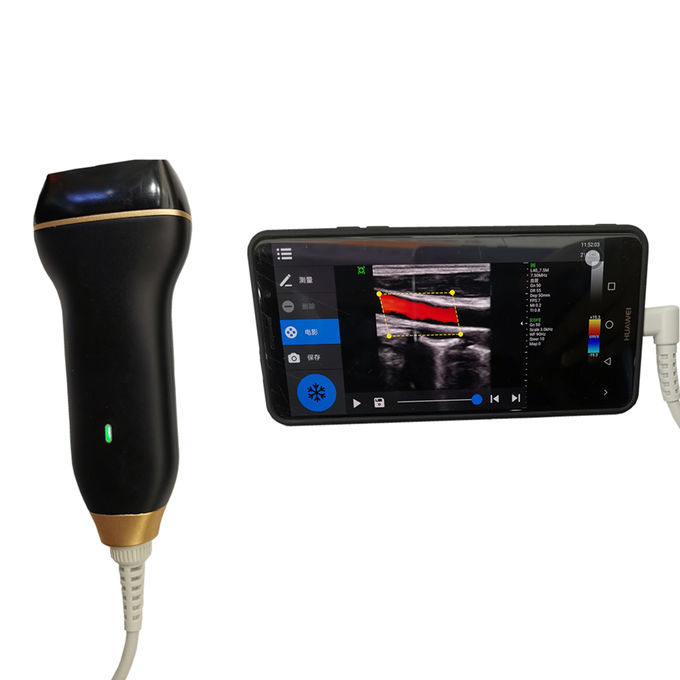 Domowa maszyna do obrazowania ultrasonograficznego Kolorowy ultrasonograf Doppler z połączeniem USB