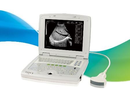 Skaner ultradźwiękowy Przenośny skaner ultradźwiękowy z monitorem LED o przekątnej 10,4 cala