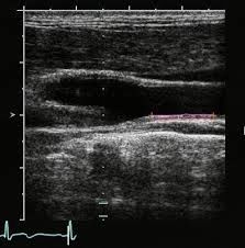 Przenośny ultradźwiękowy przenośny ultrasonograf Devics z ekranem o wysokiej rozdzielczości 10,4 cala
