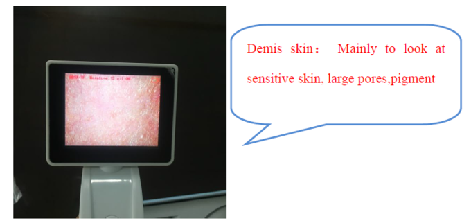 CE BS5SH Cyfrowy analizator skóry Cyfrowy miernik wilgotności skóry dla lekarza
