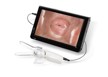 Mini-kolposkop do badania pochwy z szyjki macicy Podłączony do telewizora lub komputera