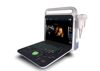 15-calowy kolorowy ultrasonograf Doppler Maszyna o wysokiej rozdzielczości ekran LCD