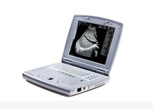 Przenośny ultrasonograf dla niemowląt Przenośny ultrasonograf dla dzieci