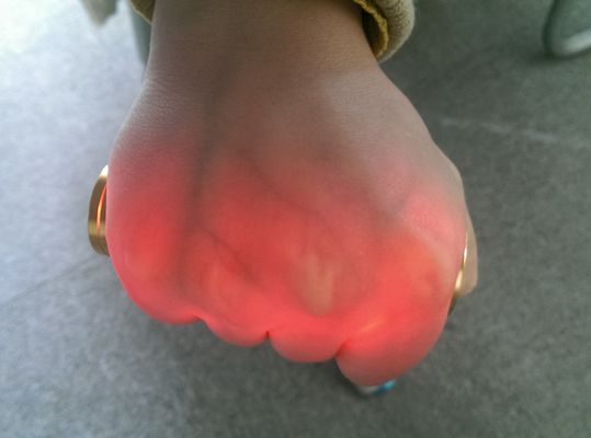 Przenośna lampowa lampa projekcyjna Venipuncture Wizjer podczerwieni Finder żyłownik Złoty aluminium