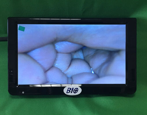 Przenośny cyfrowy kolposkop elektroniczny