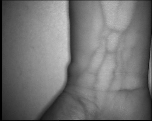 Wysokiej rozdzielczości 800X480 Typ tabeli Urządzenie do lokalizowania żył z 3,5-calowym ekranem do ramienia ręki