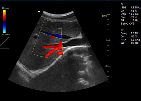 15-calowa pełna cyfrowa kolorowa maszyna dopplerowska Przenośne ultradźwięki obrazowania dopplerowskiego z 2 portami USB