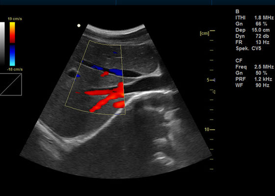 15-calowa pełna cyfrowa kolorowa maszyna dopplerowska Przenośne ultradźwięki obrazowania dopplerowskiego z 2 portami USB