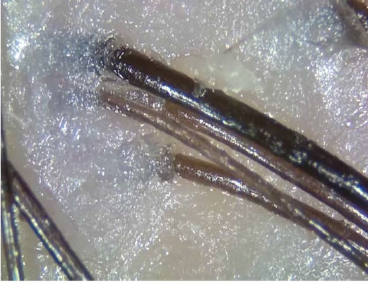 Przenośne bezprzewodowe urządzenie do diagnostyki telemedycznej z analizatorem skóry ze światłem spolaryzowanym