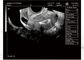Przenośny ultrasonograf do ciąży Przenośny ultrasonograf Waga zaledwie 2,2 kg