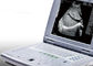 Przenośny ultrasonograf do ciąży Przenośny ultrasonograf Waga zaledwie 2,2 kg