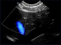 Mini kieszonkowy ręczny skaner ultradźwiękowy Kolorowa sonda Dopplera Wymienna z częstotliwością 2 ~ 11 MHz