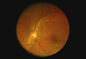 Oftalmoskop Przenośna ręczna kamera dna oka Telemedycyna Dostępna rozdzielczość wideo 1280 x 960 pikseli