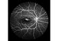 Laserowy aparat do skanowania dna oka Profesjonalny sprzęt okulistyczny z obrazowaniem dna oka FOV 160 ° Minimalna wielkość źrenicy 2 mm
