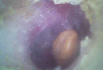 Przenośny zakres ENT Ekonomiczny ręczny cyfrowy otoskop wideo z kartą Micro SD Flash 32G