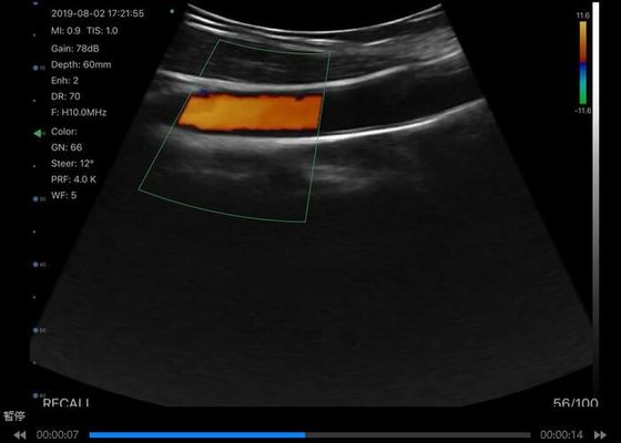 cyfrowy bezprzewodowy ręczny skaner ultradźwiękowy