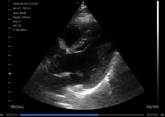 cyfrowy bezprzewodowy ręczny skaner ultradźwiękowy