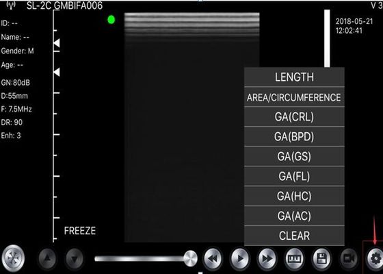 Ręczny skaner ultradźwiękowy 5G Wypukły: 3,5 ~ 5 MHz, Liniowy: 7,5 ~ 10 MHz, Sercowy: 2,5 ~ 5 MHz