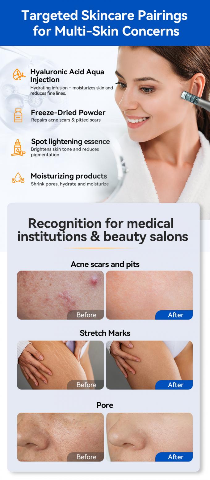 Oryginalny Brand Hydra Pen H5 Mikronakłuwanie Derma Pen z EMS Regulowane Serum Wyjście MTS Redukcja Blizn Drobne Linie Zmarszczki 6