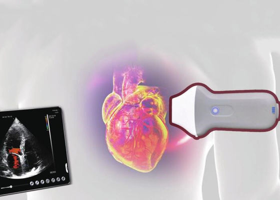 Bezprzewodowy przenośny skaner ultradźwiękowy PDI WiFi 128 elementów